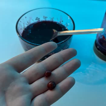 A101 Saraçlar Şubesinde Vişne Reçelinde Çekirdek Nedeniyle Diş Kırılması Ve Tedavi Masrafı Talebi