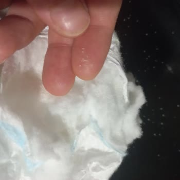 Molfix Bebek Bezinde Sert Tanecik Riski Ve Sağlık Endişesi