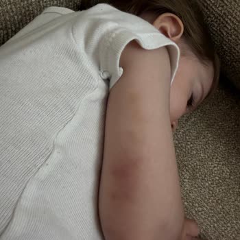 Damar Bulucu Cihazı Eksikliği Nedeniyle Bebek Damar Açma Sürecinde Yaşanan Ağır Travma