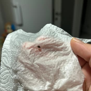Happy Life Organik Nohutta Böcek Çıktı Ve Aile Sağlığımız Tehlikede