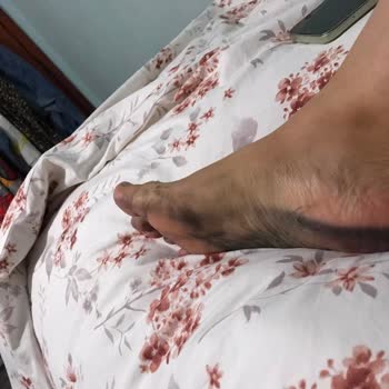 Ayakta Boya Bırakan Sandalet İçin Ayıplı Ürün Şikayeti Ve Değişim Talebi