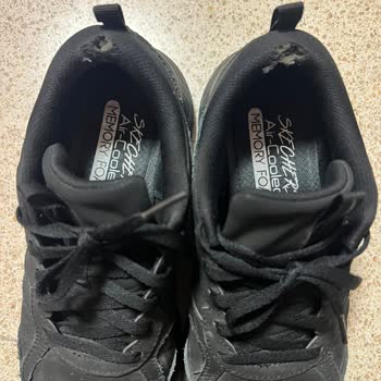 Skechers Ayakkabısında Üretim Hatası Nedeniyle Yırtılma Ve Deformasyon