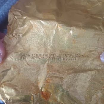 Metal Parçası İçeren Salsa Tavuk Ürünü Diş Kırılmasına Sebep Oldu Ve Şirket İlgisiz Davrandı