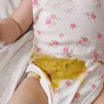 Kalitesiz Yeni Bezler Kaka Ve Çiş Sızdırıyor, Ürün Değişimi Ve İade İstiyorum