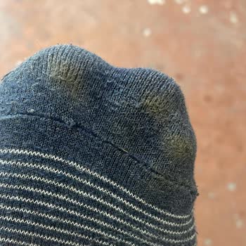 Hotiç Mağazasındaki Ayakkabılarda Boya Ve Patlama Sorunu, İade Reddi