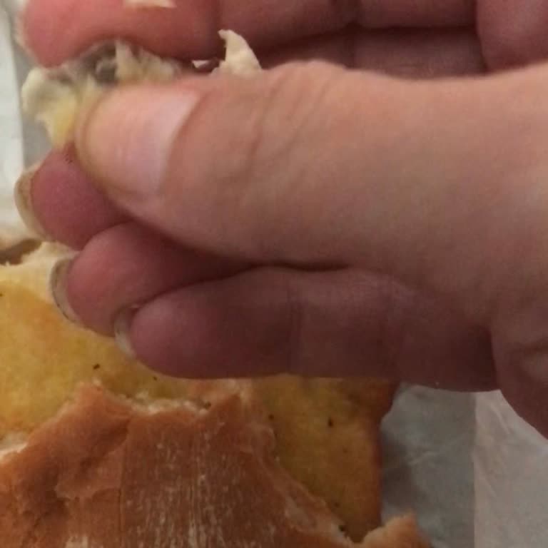 Burgerde Büyük Kemik Parçası Damağa Çarptı, Sağlık Riski Ve Destek İhmali