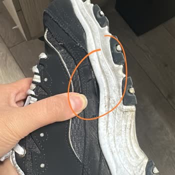 Yan Açılmalar Nedeniyle Skechers Ayakkabısının Değişim Talebi