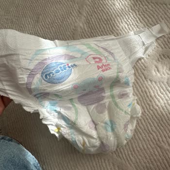 Molfix Islaklık Göstergesi Hatalı, Bebekte Şiddetli Pişik