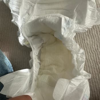 Molfix Islaklık Göstergesi Hatalı, Bebekte Şiddetli Pişik