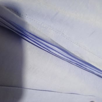 Beymen Club Gömleğinde Dikiş Sorunu Ve Satış Sonrası Destek Eksikliği