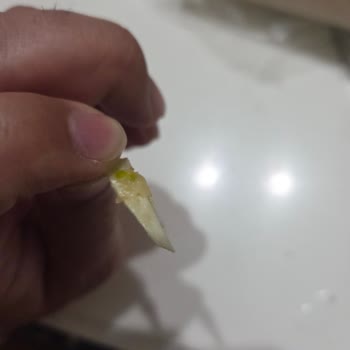 Çocuğum Helva İçindeki Plastik Parçayla Yaralandı; Şirket İlgisiz Kaldı