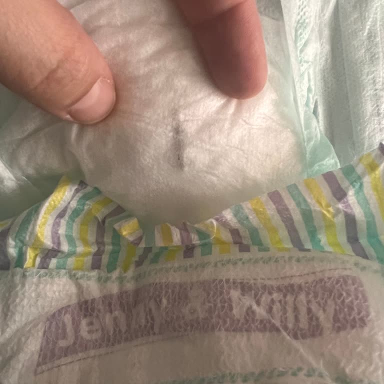 BİM Bebek Bezinde Metal Parça Keşfi Güvenlik Riski Ve Özür Talebi