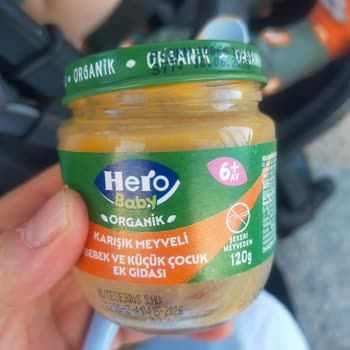 Bebek Mamasında Kıl Bulunması Ve Hijyen Endişesi