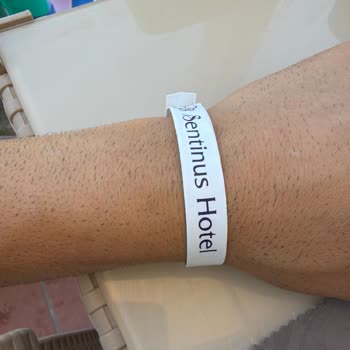 Kuşadası'ndaki Otelde Hijyen Sorunu Ve Saygısız Personel