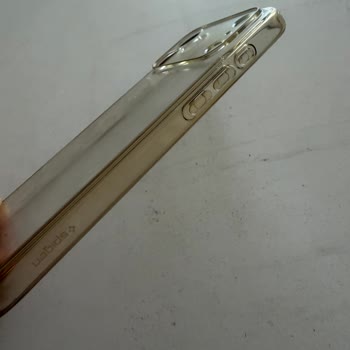 Amazon Spigen Marka Şikayeti