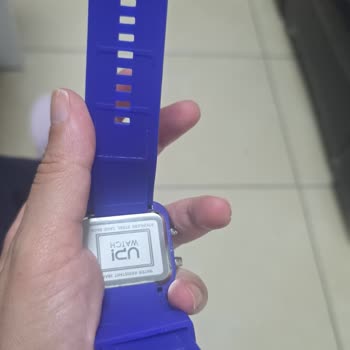 Upwatch Saatinde Kısa Sürede Kordon Soyulması Garanti Kapsamı Dışında