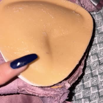 Cilt Yanığı Ve Kıyafet Bozulması Nedeniyle Cherylift Ürününden İade Talebi