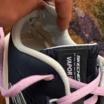 Yüksek Fiyatlı Skechers Ayakkabılarında Erken Aşınma Ve İade Reddi
