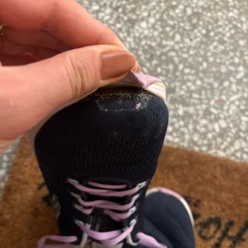 Yüksek Fiyatlı Skechers Ayakkabılarında Erken Aşınma Ve İade Reddi