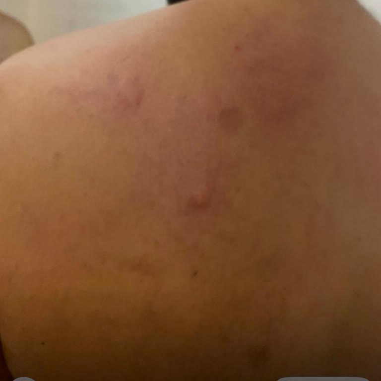 Otelde Tahta Kurusu Sorunu: Erken Çıkmak Zorunda Kaldık