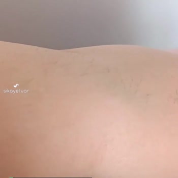 Serlux Beauty Lounge Mağduriyetim
