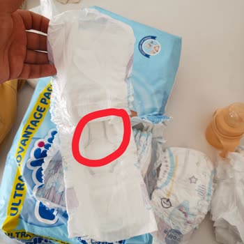 Molfix Bebek Bezi İçindeki Sert Madde Bebeğimde Şiddetli Pişik Oluşturdu