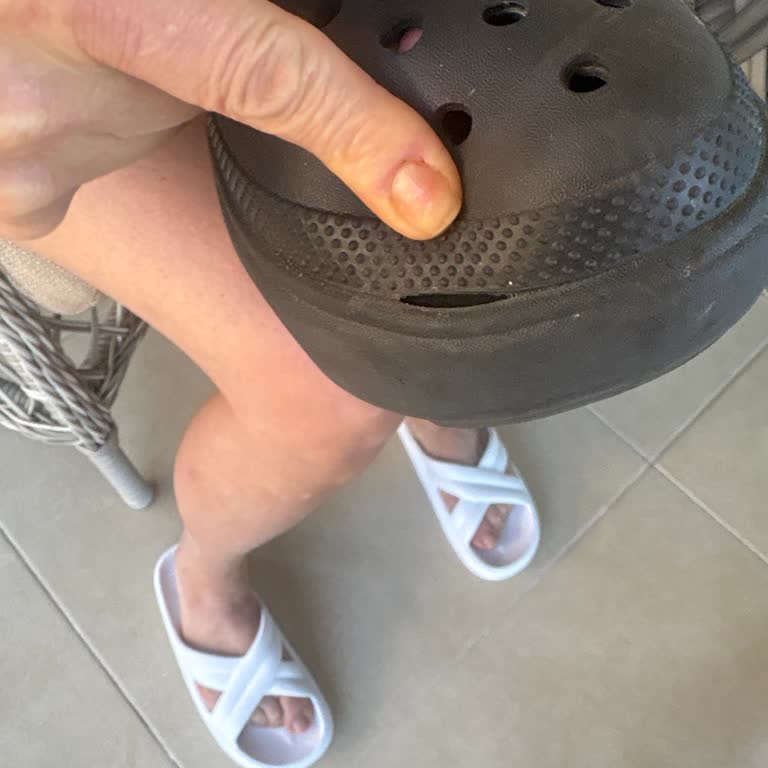 Crocs Terlikte Normal Kullanımda Yırtılma Ve Değişim Talebi