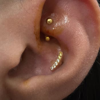 Zorlayıcı Piercing İşlemi Sonrası Şişlik Ve Enfeksiyon İçin Ücret İadesi Talebi