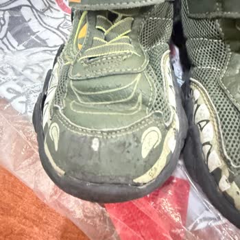 Skechers Çocuk Ayakkabısının Kısa Sürede Açılması Ve Boyner’in Garanti Reddi