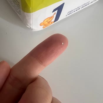 Bebek Sütü İçindeki Yabancı Parçacıklar Güven Sorunu Yaratıyor