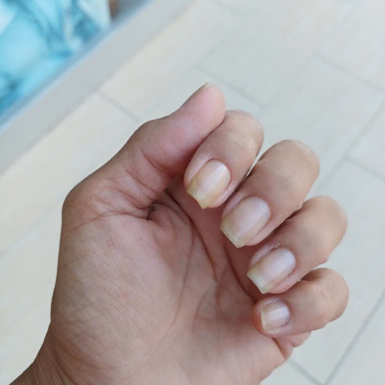 Flormar Ojesi Tırnakları Sarı Ve Turuncuya Dönüştürdü