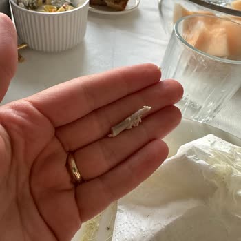 Hastavuk Pesto Göğüs Ürününün İçinde Keskin Kemik Parçası