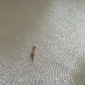 Hastavuk Pesto Göğüs Ürününün İçinde Keskin Kemik Parçası