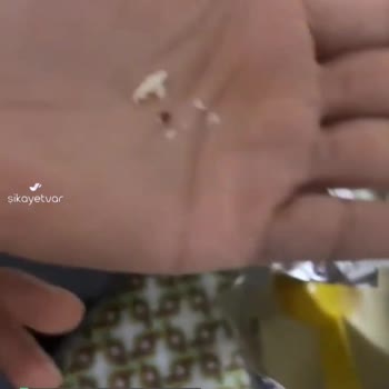 Mamamil Sürekli Kullandığım Mamanın İçinden Böcek Çıktı!