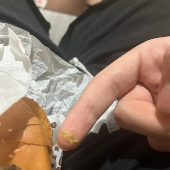 Eksik Ve Yanlış Burger King Siparişi İçin Trendyol GO'dan İade Reddedildi
