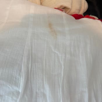 İstanbul Kalesi Starı’nın Bavul Hasarı Ve Müşteri Hizmetleri İhmali