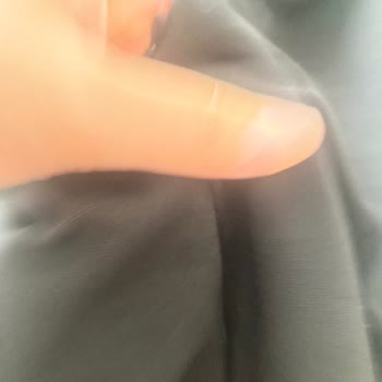 Kusurlu Elbise Ve Kaba Müşteri Temsilciliği İçin Ücret İadesi Talebi