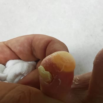 Ayakkabının İlk Giyişte Su Toplaması Ve Geri Bildirim Almadan İade Sürecinin Uzaması