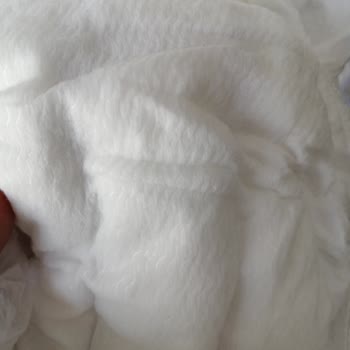 Sleepy 2 Numaralı Bebek Bezindeki Naylon İç Yüzey Pişik Ve Kızarıklığa Yol Açtı
