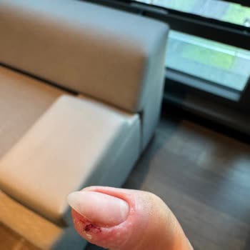 Cansay Nail Beauty’de Tırnak Kesimi Sırasında Hijyen İhlali Ve Kanama