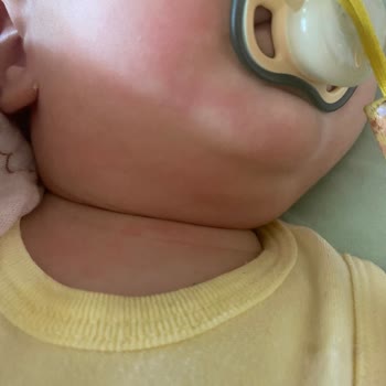 Bebek Cildinde Kızarıklığa Neden Olan Uni Baby Islak Mendili