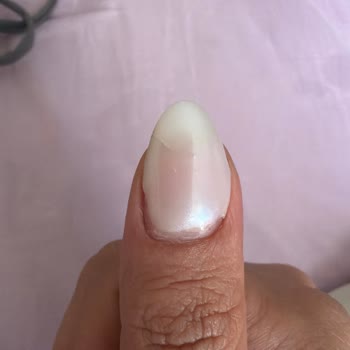 Ankara Kızılay'da Bera Beauty Salon'da Kötü Protez Tırnak Sonrası Şiddetli Ağrı Ve Aşırı Ücret