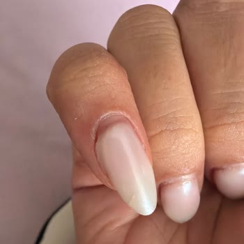 Ankara Kızılay'da Bera Beauty Salon'da Kötü Protez Tırnak Sonrası Şiddetli Ağrı Ve Aşırı Ücret