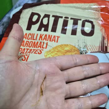 Patito Cipsinde Tüy Şeklinde Yabancı Madde Bulundu