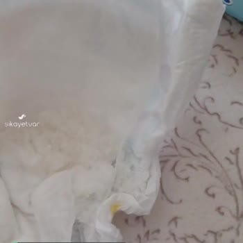 Molfix 4 Numara Bebek Bezi Patladı!