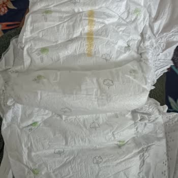 E-Bebek’ten Açılan Bez İadesi Reddi Ve Sleepy Beziyle Bebek Pişiği Şiddetlenmesi
