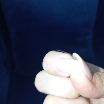 Magnum Dondurmasında Saç Benzeri Kıl Görülmesi Hijyen Endişesi
