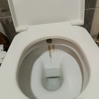 Royal Beach Gümüldür Otelinde Hijyen Ve Yanıltıcı Reklamlar Nedeniyle Mağduriyet