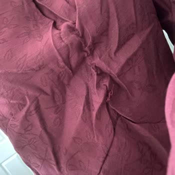 Kusurlu Elbise Teslimatı Ve Yanıtsız Müşteri Desteği