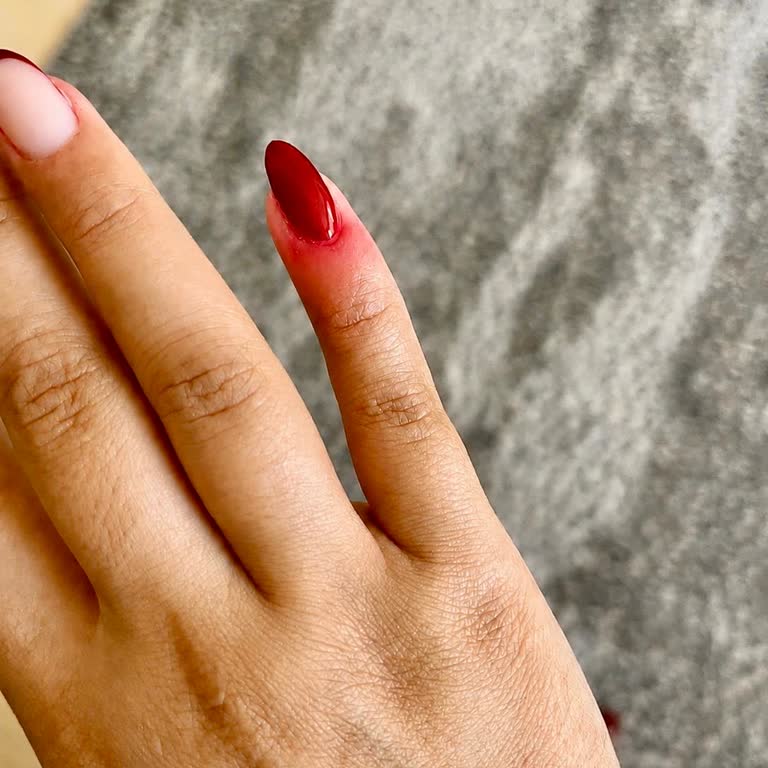 Başak Nail Studio’da Protez Tırnak Ağrısı Ve İade İhmalı